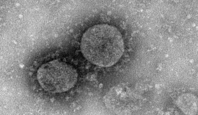 Imagen de Coronavirus al Microscopio electrónico