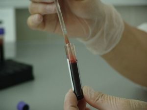 prueba rápida de anticuerpos de sifilis